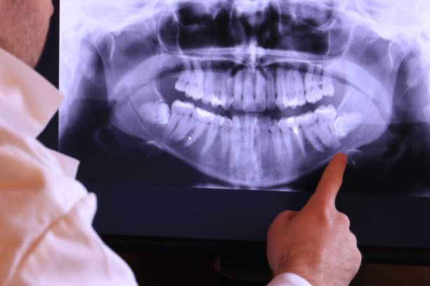 Best Chipped Tooth Repair Near Me  in Hoopers Creek, NC